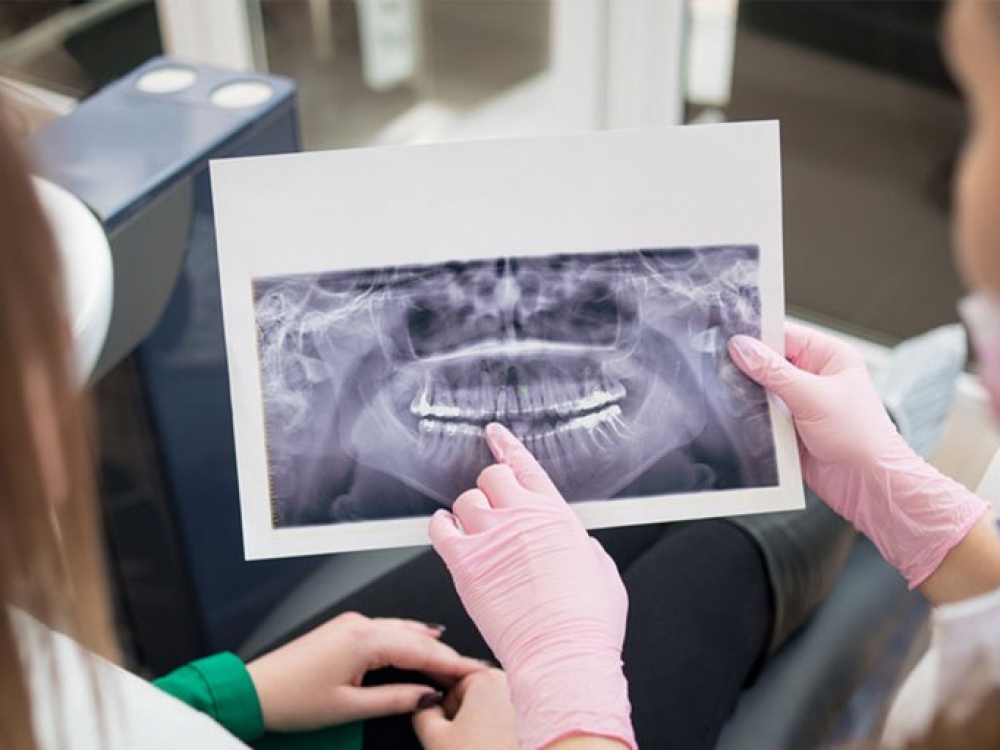 Kuo anksčiau nustatomas polinkis sirgti periodonto ligomis, tuo geresni rezultatai pasiekiami. Gera žinia - dantenų uždegimas yra visiškai išgydomas.