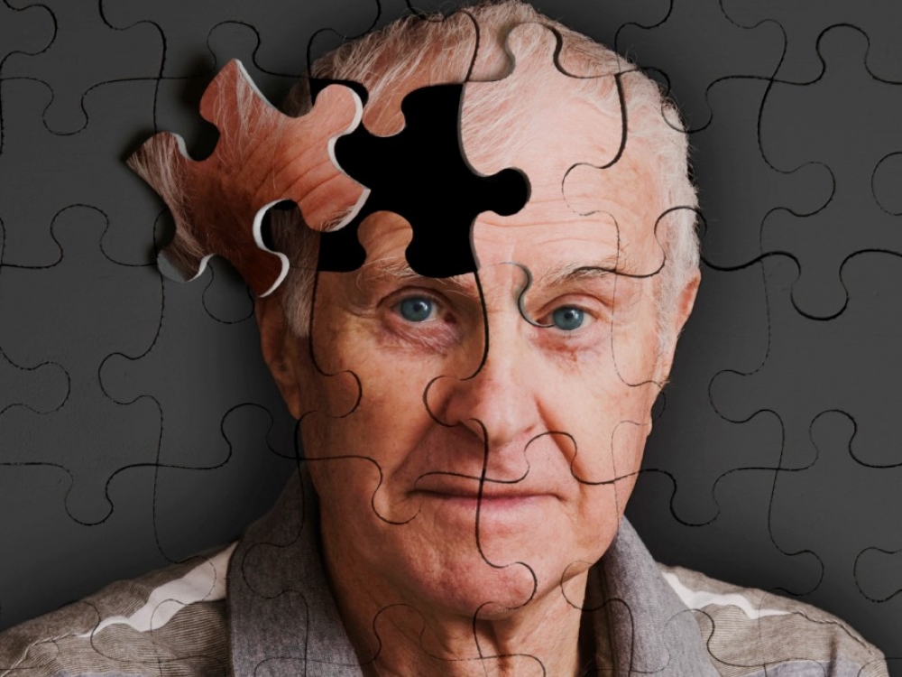 Lietuvoje Alzhaimerio ligos diagnozė dažniausiai nustatoma septyniasdešimt penkerių aštuoniasdešimties metų pacientams.