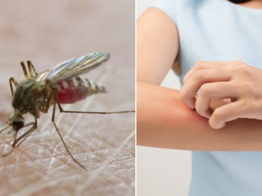 Pasak gamtininkų, dėl pernai buvusios ypač sausringos vasaros, taip pat ir netradiciškai šiltos žiemos uodų pamiškėse kone dešimtkart mažiau nei pastaraisiais metais.
