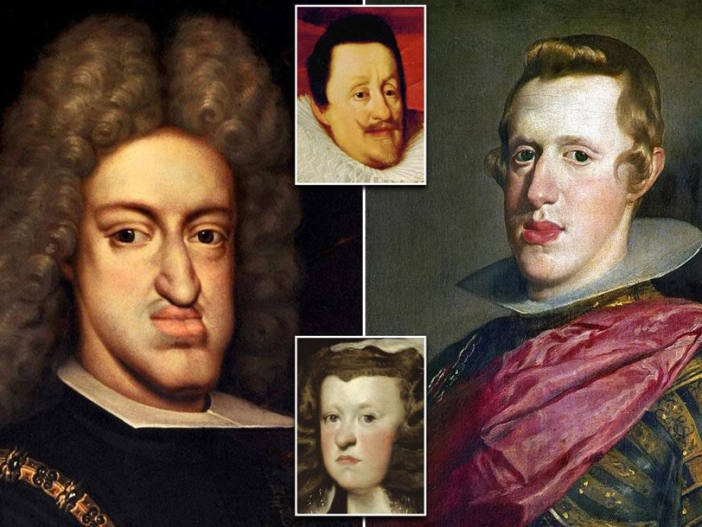 Ispanijos Habsburgai išmirė dėl apsigimimų
