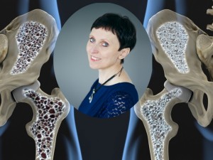 Jolanta Dadonienė: „Atitolinti osteoporozę įmanoma“