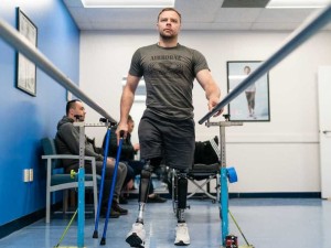 Ukrainiečiams – nemokami protezai iš JAV