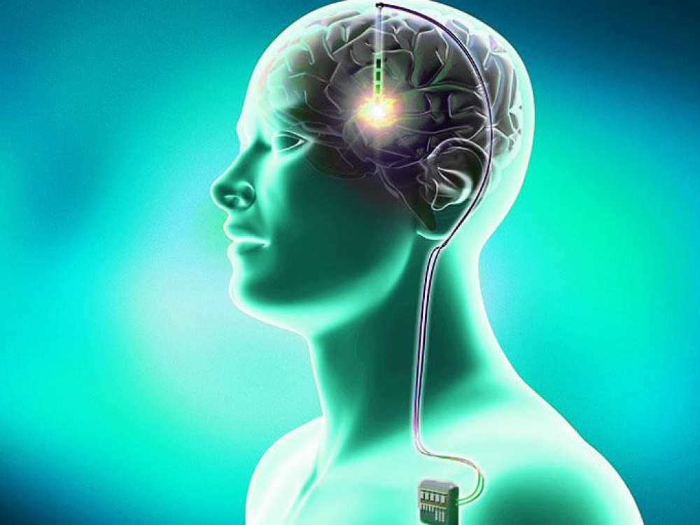 Sergant Parkinsono liga, visais atvejais skiriamas gydymas vaistais ir tik nedidelei pacientų daliai gali būti naudinga stimuliacija per elektrodus, implantuotus į galvos smegenų pusrutulių gilumines struktūras.