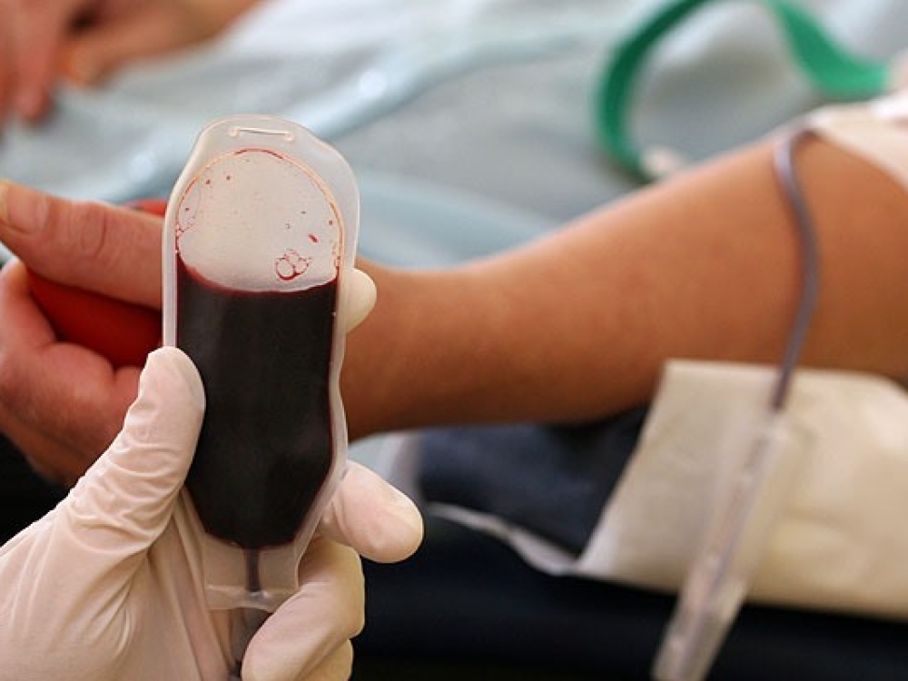 Moterys, nešiojančios hemofilijos geną, atitinkamai turėtų būti ruošiamos ir nėštumui. Jeigu šeimoje yra hemofilijos istorija, ja sirgo tėvai, giminaičiai, moteriai planuojant nėštumą, pirmiausiai reikėtų išsitirti.