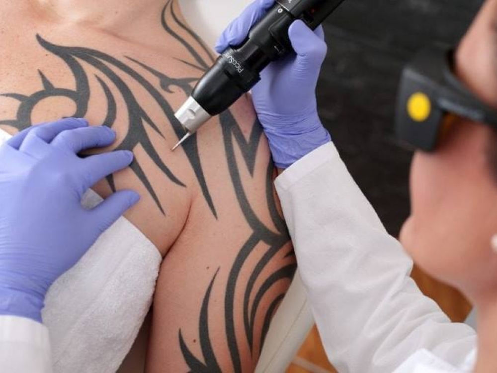 Tatuiruotė paprastai užgyja per 2–4 savaites, priklausomai nuo jos dydžio, detalių sudėtingumo, kūno vietos ir individualių odos savybių. 