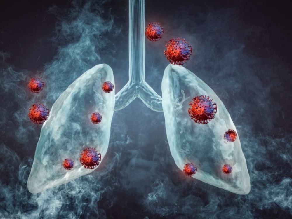 Tyrimų metu nustatyta, kad tiems, kuriems buvo skiriamas PARP inhibitorius niraparibas, mezoteliomos progresavimo ar mirties rizika sumažėjo 27 proc. Tai atitolino mezoteliomos paūmėjimą vidutiniškai 1,5 mėnesio, palyginti su tais, kuriems buvo taikomas standartinis gydymas.