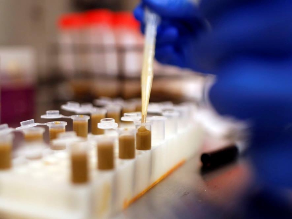 Išmatų kapsulių idėja gal ir skamba keistai, bet nėra naujiena. Išmatų transplantacijos jau patvirtintos stipriam viduriavimui, kurį sukelia Clostridium difficile bakterija, gydyti. Tačiau mokslininkai pastebėjo, kad šios transplantacijos gali padėti atsikratyti ir superbakterijų. 