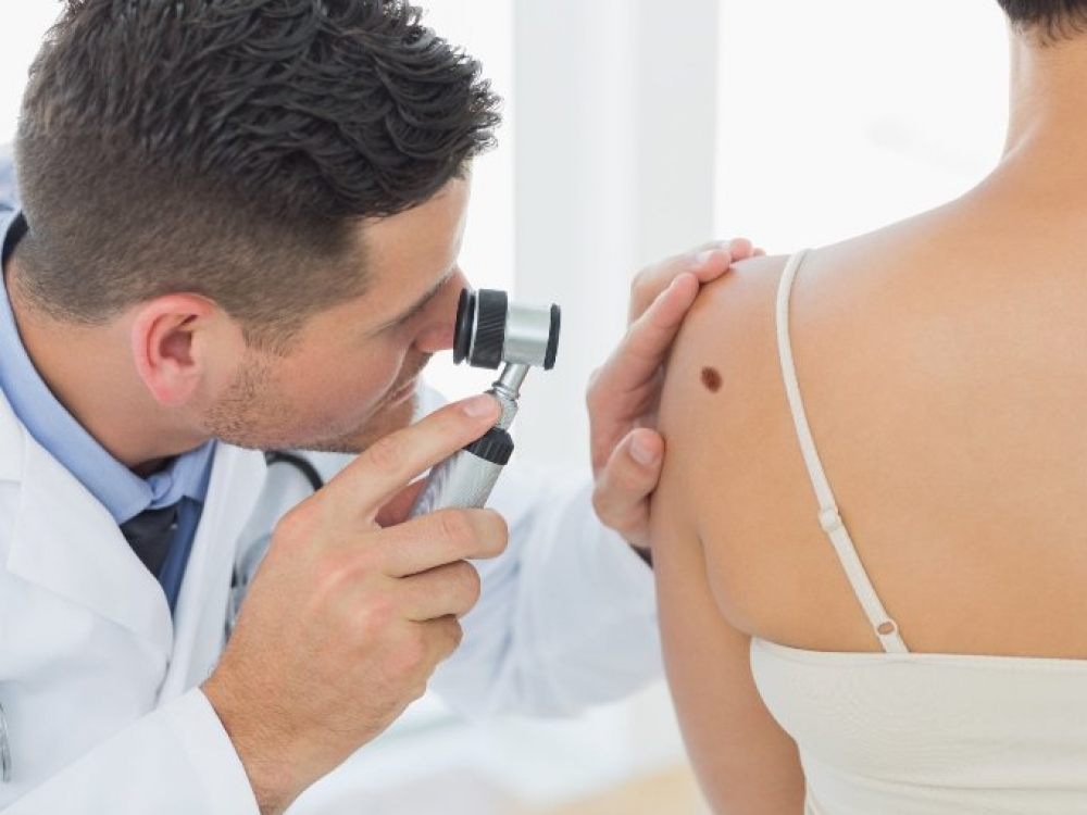 Mūsų šalyje kasmet vidutiniškai nustatoma apie 350 naujų melanomos atvejų. Du trečdaliai pacientų – moterys.