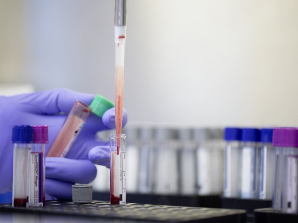 Naujos PSO rekomendacijos taikyti vieningą prevencinį latentinės tuberkuliozės infekcijos patikrinimą ir jos gydymą tarp pažeidžiamų grupių didelio ir mažo sergamumo šalyse – svarus žingsnis pasaulyje kovojant su tuberkulioze. Dabar gama interferono išsiskyrimo tyrimai ar tuberkulino odos testai gali būti naudojami latentinės tuberkuliozės testavimui visame pasaulyje, nebeatsižvelgiant į pajamų rodiklius.
