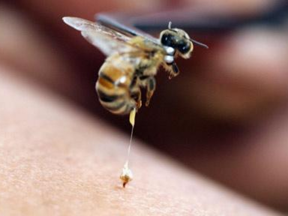Bičių įgėlimams alergiškiems žmonėms reikėtų visada su savimi visada turėti vienkartinių švirkštų, adrenalino, vaistų nuo alergijos ampulėmis.